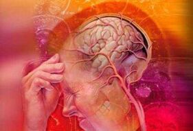 Osteokondroz için hipertansiyon